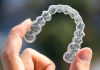Addressing Crooked Teeth Is About More Than Your Smile invisalign