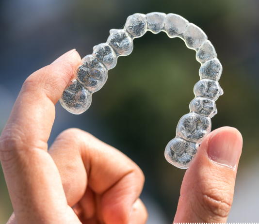 Addressing Crooked Teeth Is About More Than Your Smile invisalign