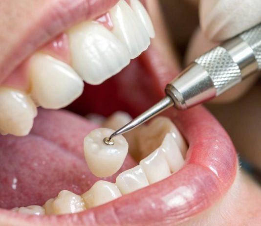 Which Tooth Replacement Option Is Right For Me? missing teeth dental treatment