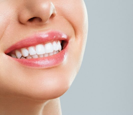 The Pros and Cons of At-Home Teeth Whitening teeth whitening