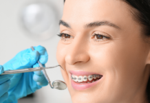 Three Ways to Put the Finishing Touches on Your Teeth After Orthodontics cosmetic treatments after orthodontics