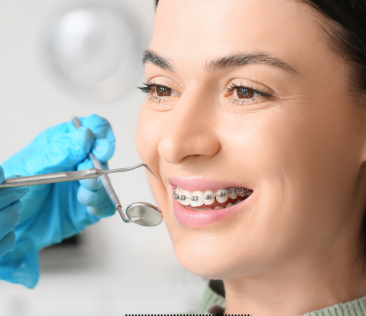 Three Ways to Put the Finishing Touches on Your Teeth After Orthodontics cosmetic treatments after orthodontics
