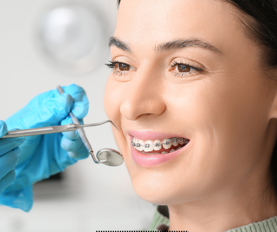 Three Ways to Put the Finishing Touches on Your Teeth After Orthodontics