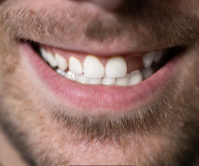 missing tooth