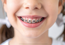 When Should My Child Start Orthodontic Treatment? children orthodontics