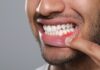 Hidden Ways That Anxiety Can Affect Your Teeth and Gum Health gum health