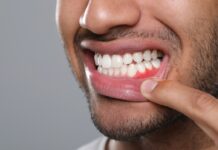 Hidden Ways That Anxiety Can Affect Your Teeth and Gum Health gum health