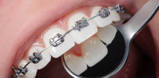 What Happens During an Orthodontic Consultation? orthodontics
