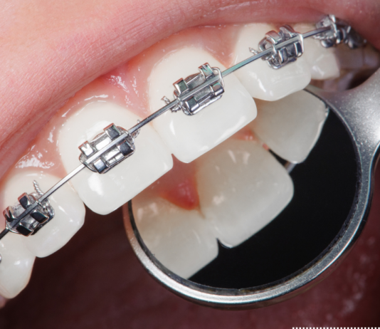 What Happens During an Orthodontic Consultation? orthodontics