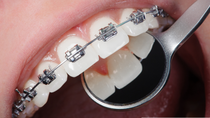 orthodontics