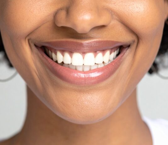 How Cosmetic Dentistry Impacts Your Body Language cosmetic dentistry
