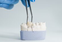 5 Reasons You May Need a Dental Crown dental crown lansdowne va