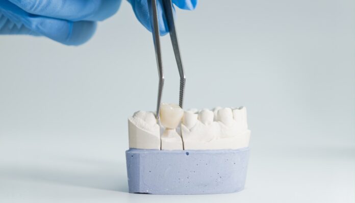 dental crown lansdowne va