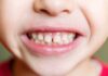 The Role of Baby Teeth in Speech Development children dentistry baby teeth