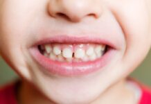 The Role of Baby Teeth in Speech Development children dentistry baby teeth
