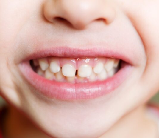 The Role of Baby Teeth in Speech Development children dentistry baby teeth