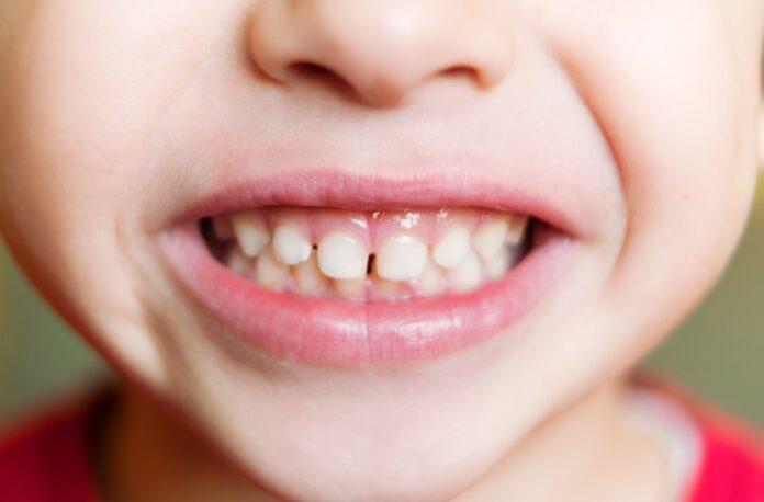 children dentistry baby teeth