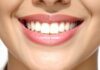 How Tooth Shape Affects Your Overall Appearance