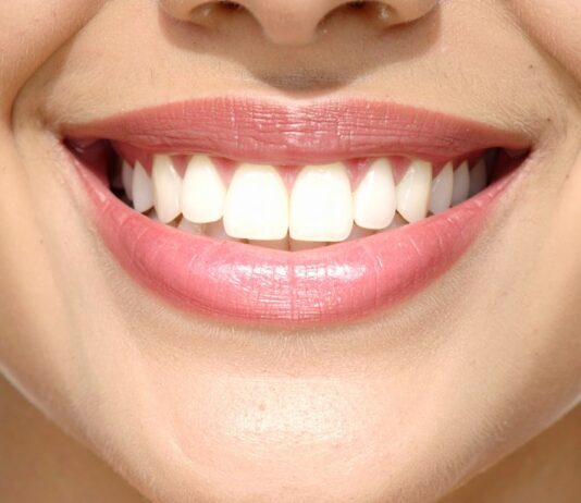How Tooth Shape Affects Your Overall Appearance