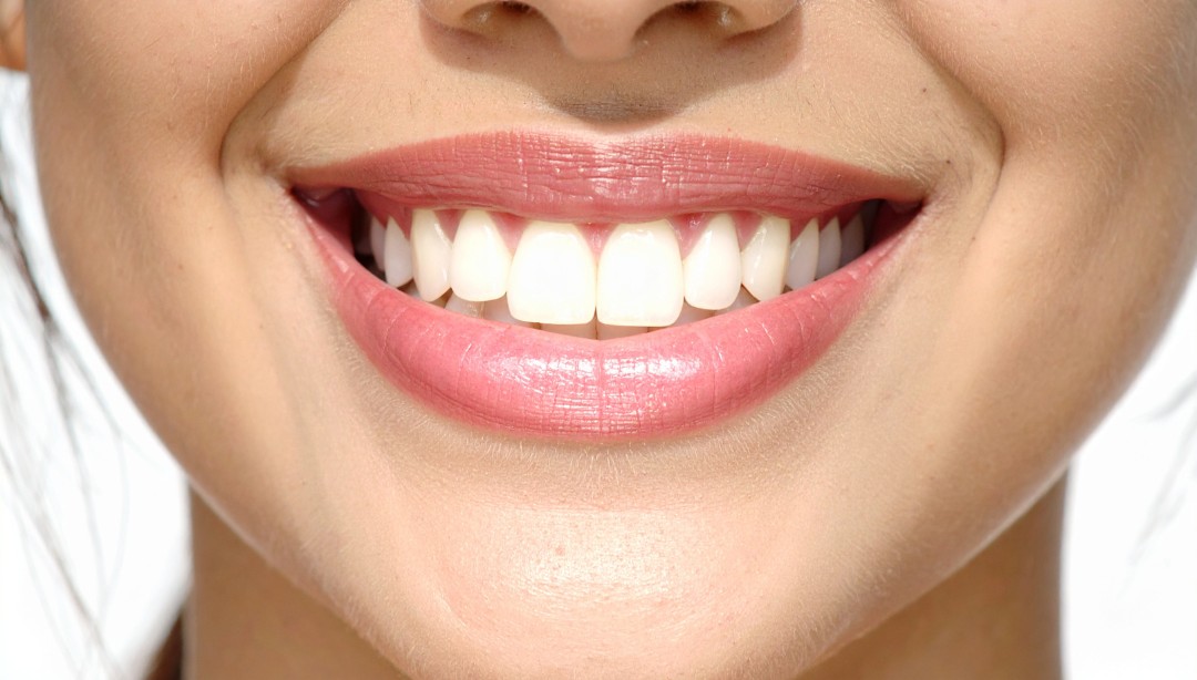 How Tooth Shape Affects Your Overall Appearance