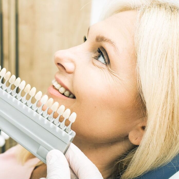 smile makeover