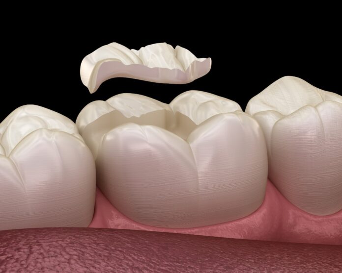 tooth filling aldie va