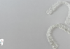 How Technology Is Changing Orthodontic Treatment invisalign