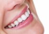 What Is Edge Bonding and When Is It Used? edge bonding teeth cosmetic dentistry