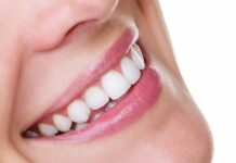 What Is Edge Bonding and When Is It Used? edge bonding teeth cosmetic dentistry