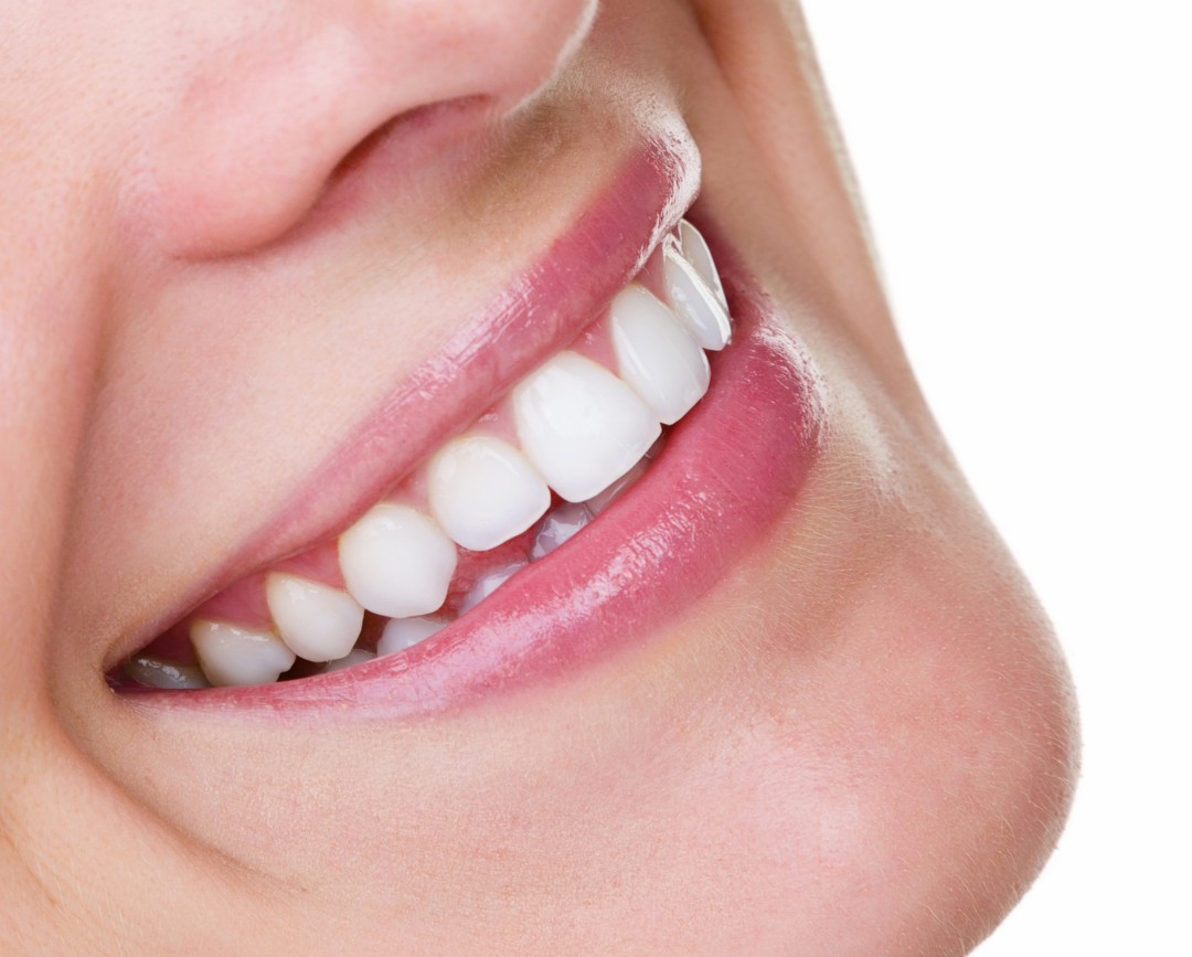What Is Edge Bonding and When Is It Used?