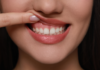 Can Cosmetic Dentistry Fix Uneven Gum Lines? gum contouring cosmetic dentistry orangevale ca