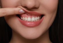 Can Cosmetic Dentistry Fix Uneven Gum Lines? gum contouring cosmetic dentistry orangevale ca