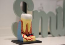 What Are Cracked Teeth and How Are They Treated?