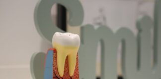 What Are Cracked Teeth and How Are They Treated?