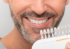 How to Maintain Your Teeth Whitening Results Long-Term professional teeth whitening leesburg va