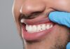 What Causes Receding Gums? receding gums