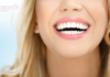 Combining Cosmetic and Restorative Dentistry for Full Smile Rehab cosmetic and restorative dentistry