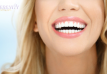 Combining Cosmetic and Restorative Dentistry for Full Smile Rehab cosmetic and restorative dentistry